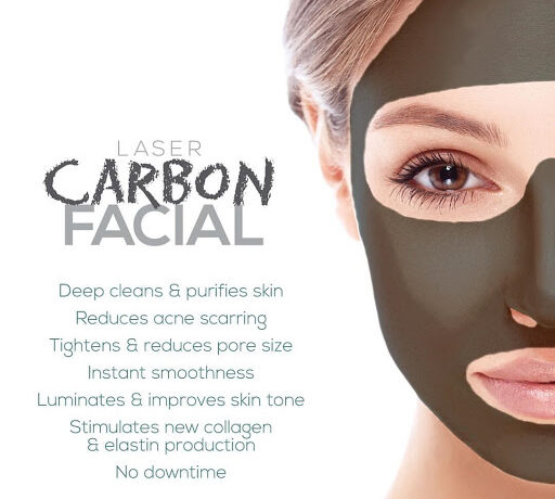 Carbon facial treatment at Ukaash clinic