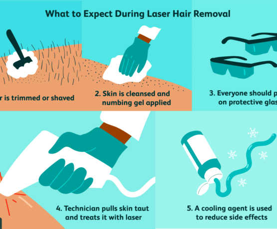 Laser hair removal service